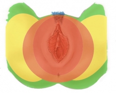 Bild 2: Schematische Darstellung einer Wärmebildmessung weiblicher Genitalien